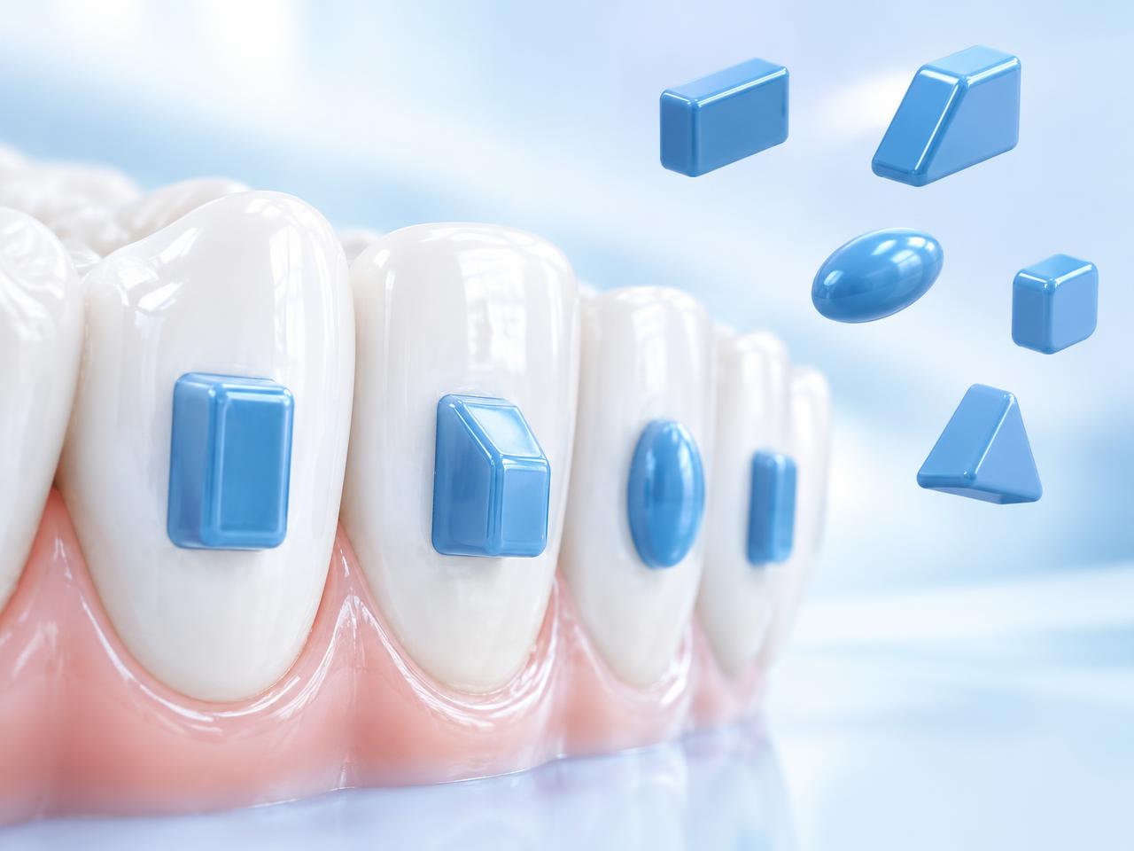 Dentes com attachments de diferentes formatos